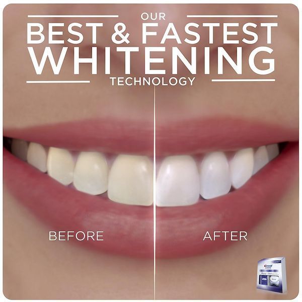 Набор полосок для отбеливания зубов Crest 3D Whitestrips с LED лампой 20шт 8763 фото